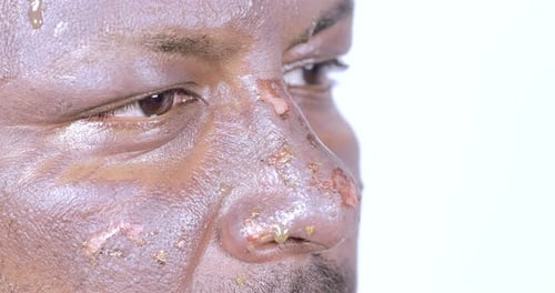 Close Up of Adult's Sweaty, Abrasive Face