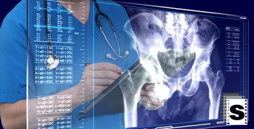 Examen de osteoporosis