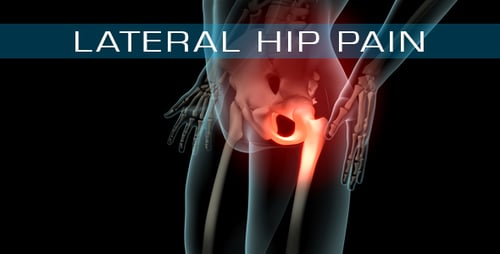 Lateral Hip Pain