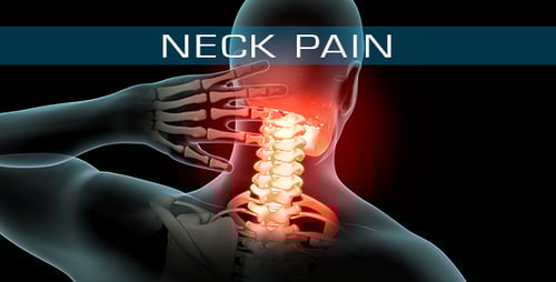 3D Human Anatomy Neck Pain Medical Animation