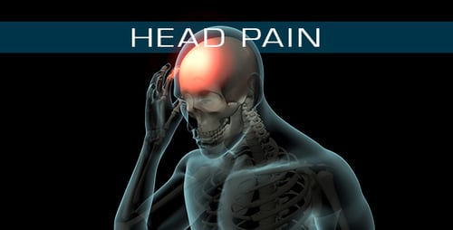 Animated 3D Human Skeleton with Head Pain Visualization
