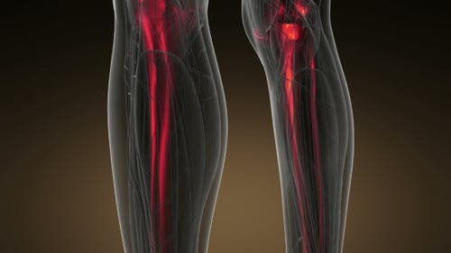 3D Human Body Scan Showing Bones and Joints with Red Glow