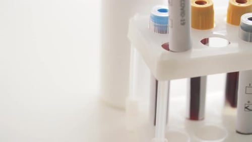 Hand with Beaker with Coronavirus Blood Test