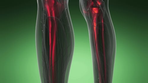 3D Scan of Human Skeleton and Joint Pain Visualization