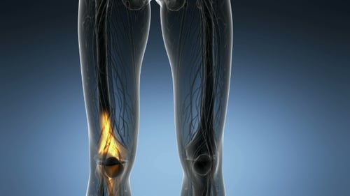 3D Human Anatomy Knee Pain Medical Visualization
