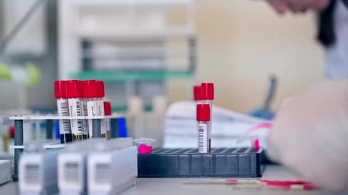 Lab Technician Working with Test Tubes