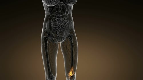 3D Human Anatomy Knee Pain Medical Visualization