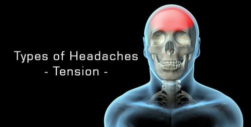 Animated Human Skull With Forehead Pain Indication