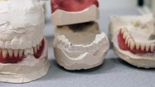 Dental Molds for False Teeth in Dental Lab