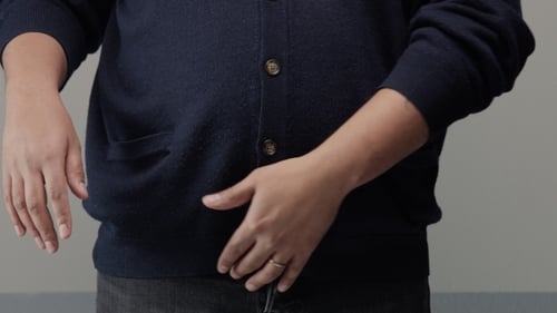 Adult Man Showing Abdomen and Excess Skin