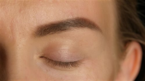 Girl Opens Her Eyes and Her Eyes Are Very Sore and Swollen