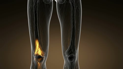 Medical Visualization of Leg Anatomy with Pain Highlight