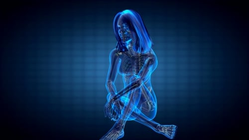Human Bones Radiographic Scan