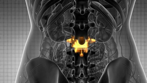 Backache in Back Bones