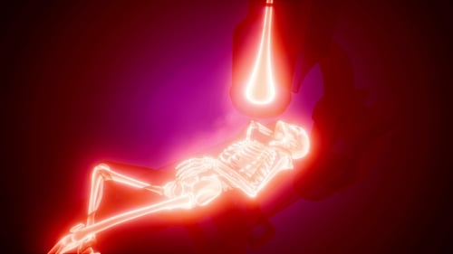 X-Ray Examination