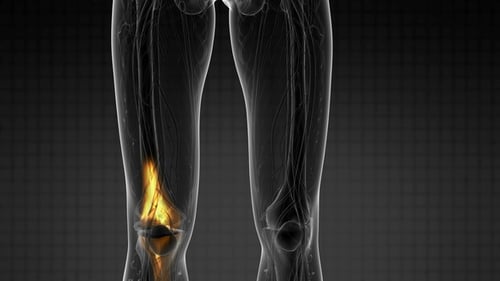 3D Human Leg Anatomy Scan with Knee Pain Highlight Animation