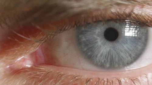 Eye of Young Person in