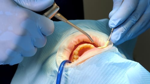 Dentist Sprays Water on Tooth and Assistant Uses Sucker During Dental Procedure. People, Medicine
