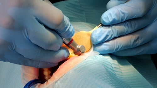 Dentist Using Instruments Inside Patient's Mouth