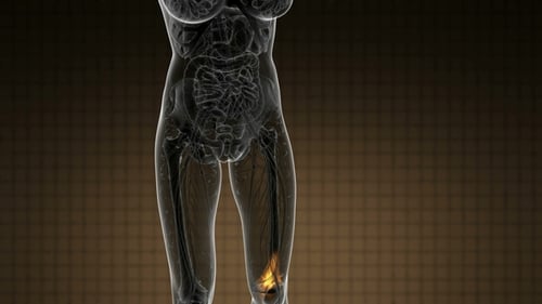 3D Transparent Human Body with Glowing Knee Pain