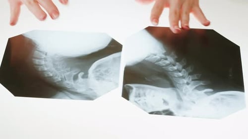 Examining Neck X-Rays with a Pen