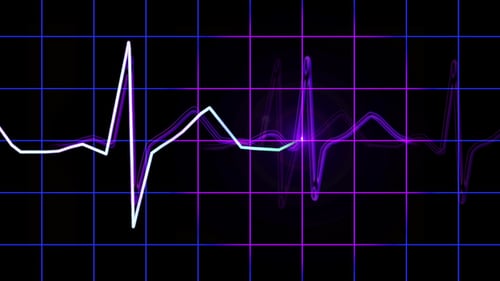 Seamless Loop Widescreen ECG Heartbeat Monitor Animation
