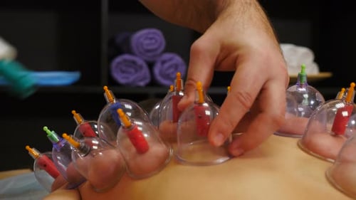 Cupping Process