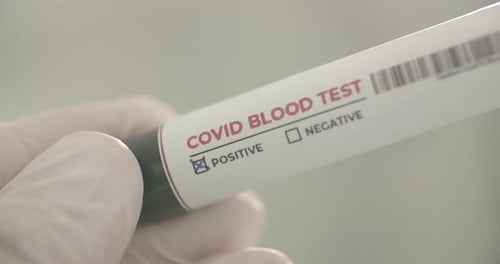 Close up of COVID Positive Blood Test in Vial