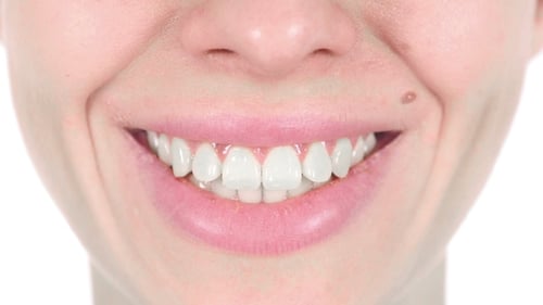 Smiling Woman with White Teeth