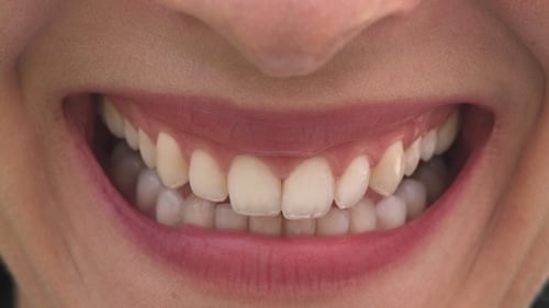 Extreme Close Up of Smiling Mouth with Teeth