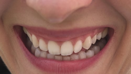 Woman's Bright Smile Close Up