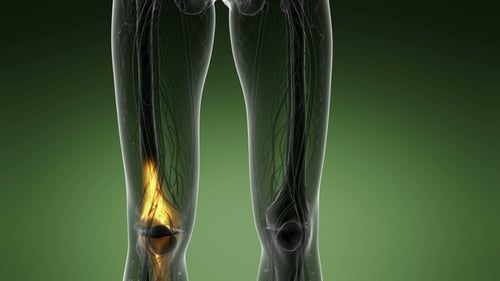 Human Body Anatomy X-Ray Scan with Highlighted Leg Pain
