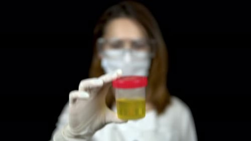 Sperm in a Test Bank Close-up. Woman Doctor Holds Out a Can of Urine To the Camera on a Black