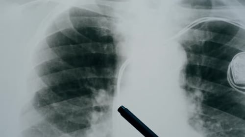 Medical X-Ray Analyzed by Gloved Hand with Pen