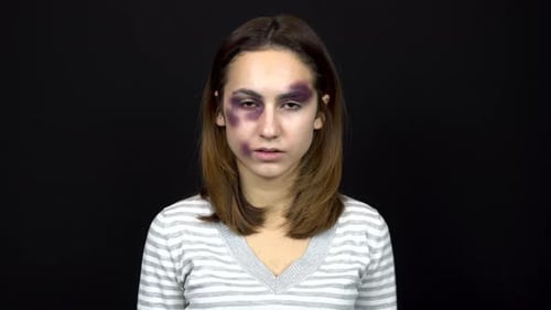 Woman With Bruising Stares and Covers Her Face