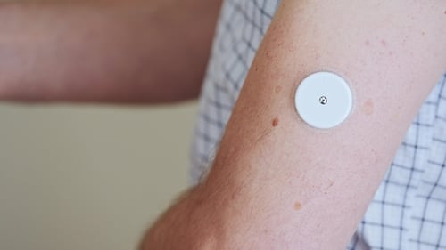 Scanning Arm with Continuous Glucose Monitor