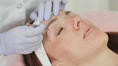 Eyebrow Procedure at Beauty Clinic