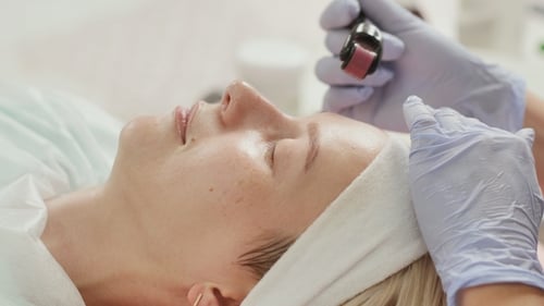 Micro Needle Facial Treatment for Youthful Skin