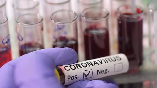 Positive Coronavirus Test Sample Marked by Hand