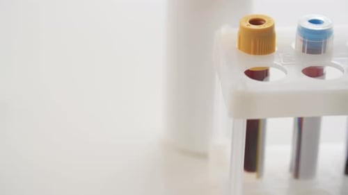 Gloved Hand Places Virus Positive Blood Sample