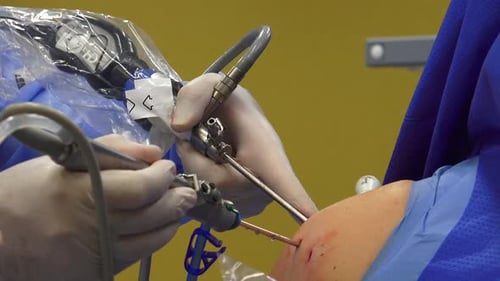 Surgeon Performs Arthroscopic Surgical Procedure in Hospital