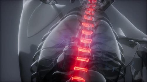 Backache in Back Bones