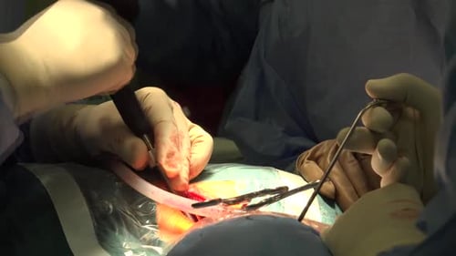Surgeons Performing Operation with Surgical Tools