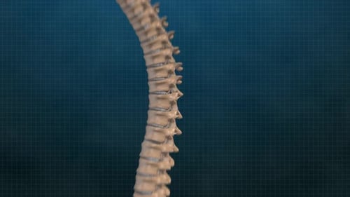 3D Human Spine Animation with Inflammation and Fracture