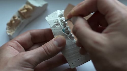 Dentist Carefully Working on Plaster Cast of Teeth