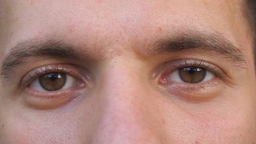 Detail View Brown Eyes of Guy Staring and Blinking with a Tired Sight