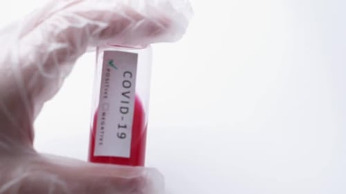 Positive COVID-19 Blood Sample in Vial