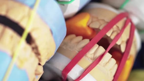 Prothèses dentaires sculptées en dentisterie