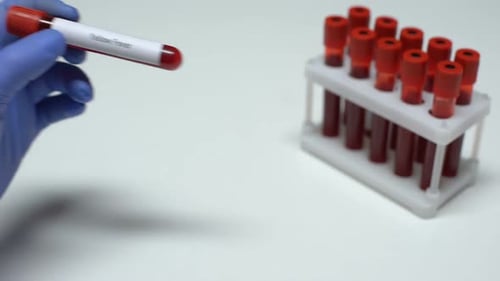 Yellow Fever Blood Test Held By Gloved Hand