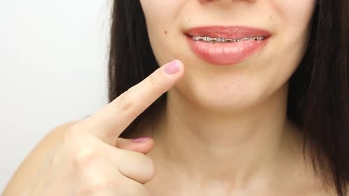 Woman Smiles with Braces and Gives Thumbs Up